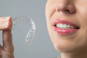Can_a_Teenager_Wear_Invisalign_637805159133804187
