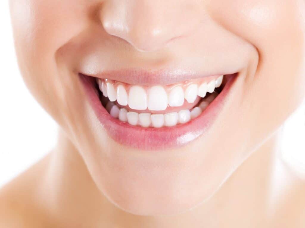 Understanding How Long a Teeth Whitening Lasts