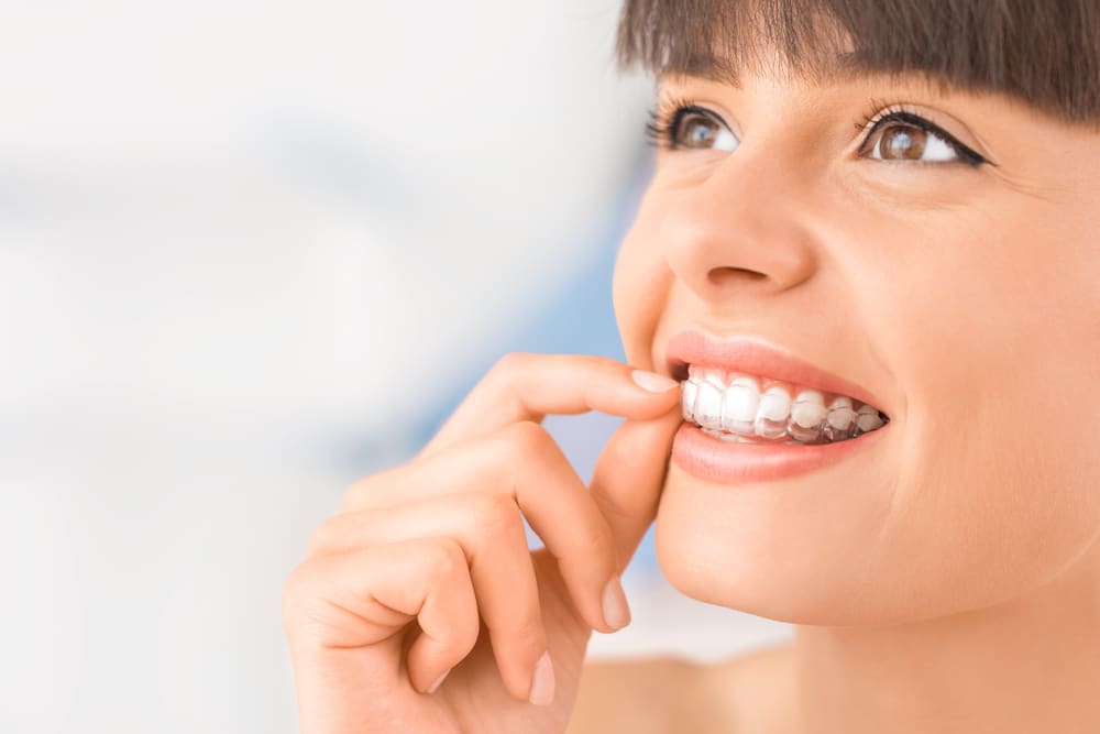 The Various Dental Conditions That Invisalign Can Fix | Runnels Orthodontics